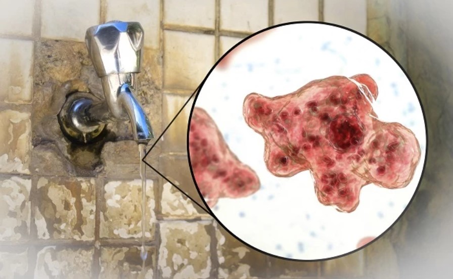 Confirman caso de amiba “comecerebros” en Florida; persona muere tras lavarse la nariz con agua de grifo